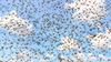 Historical perspective: The season of locust