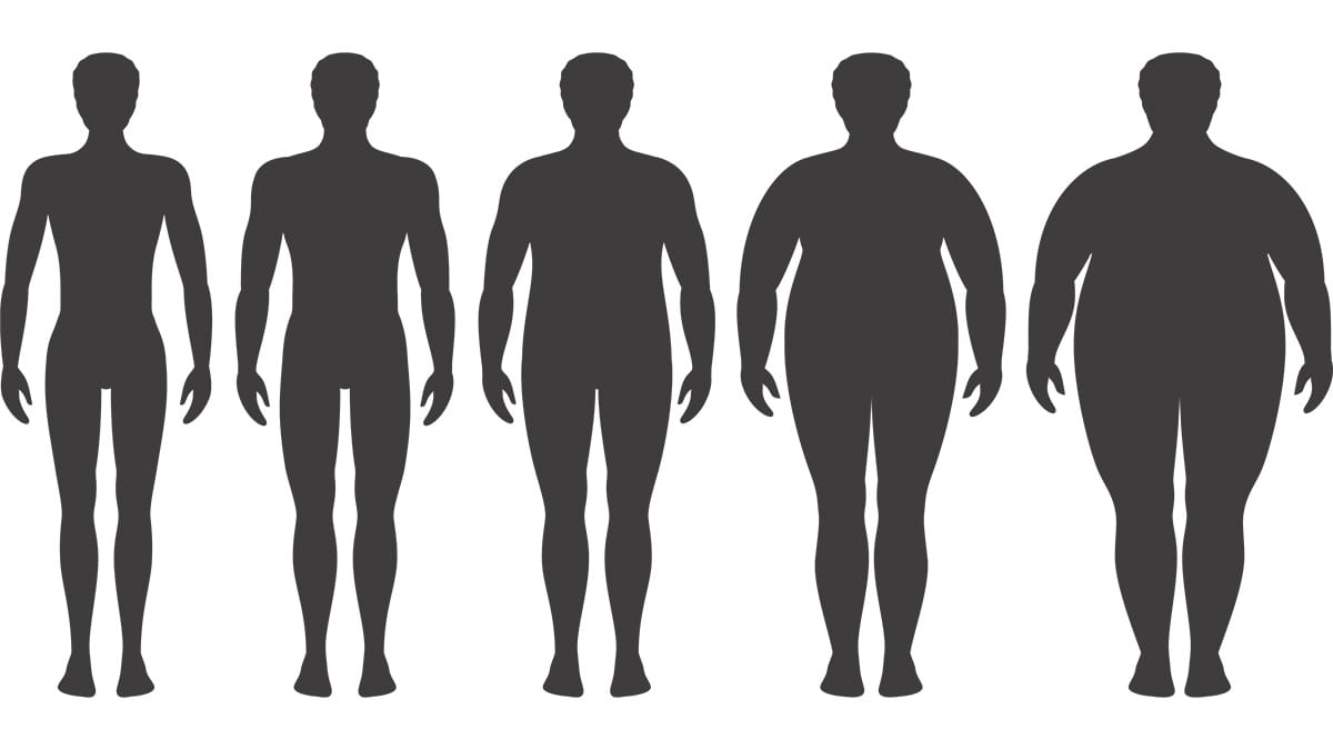 obesity-JHAH-bariatric-surgery graphic